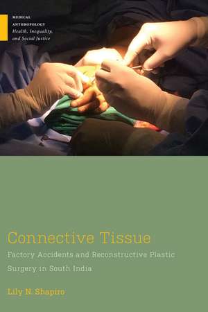 Connective Tissue: Factory Accidents and Reconstructive Plastic Surgery in South India de Lily N. Shapiro