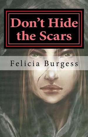 Don't Hide the Scars de Burgess, Felicia