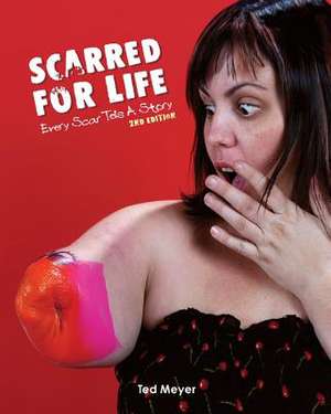 Scarred for Life. 2nd Edition de Ted Meyer