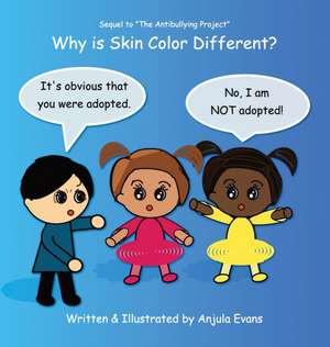 Why Is Skin Color Different? de Anjula Evans