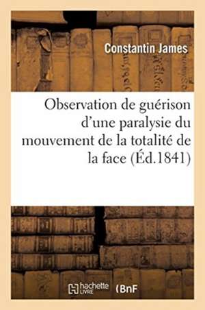 Guérison d'Une Paralysie Du Mouvement de la Totalité de la Face Dans Le Service de M. Magendie: Suivie de Considérations Générales Sur Les Causes Et L de Constantin James