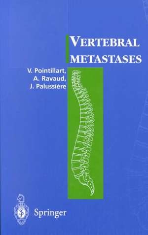 Vertebral metastases de Vincent Pointillart