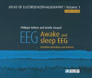 Atlas of Electroencephalography: Awake and sleep EEG de Dr Philippe Gelisse