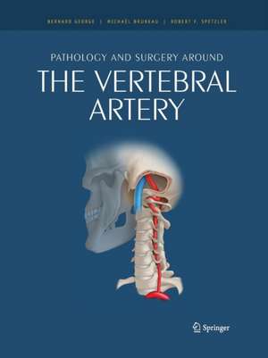 Pathology and surgery around the vertebral artery de Bernard George