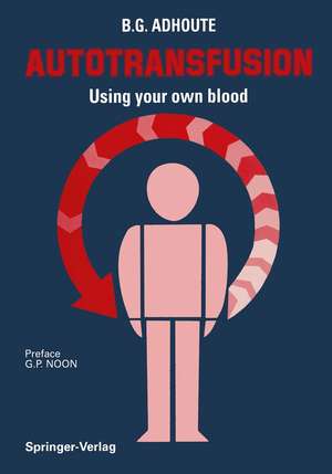 Autotransfusion: Using your own blood de K. Messmer