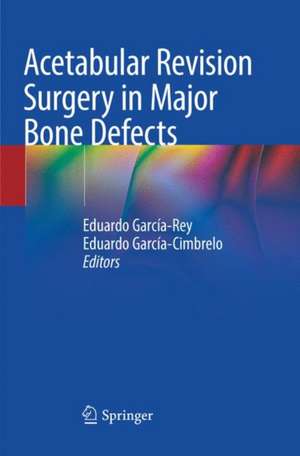 Acetabular Revision Surgery in Major Bone Defects de Eduardo García-Rey