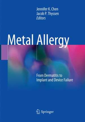 Metal Allergy: From Dermatitis to Implant and Device Failure de Jennifer K Chen