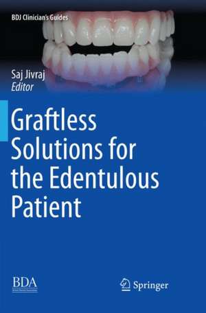 Graftless Solutions for the Edentulous Patient de Saj Jivraj