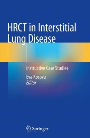 HRCT in Interstitial Lung Disease: Instructive Case Studies de Eva Kocova