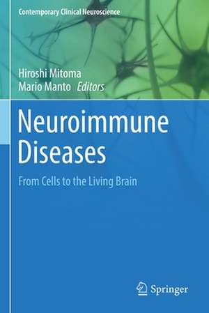 Neuroimmune Diseases: From Cells to the Living Brain de Hiroshi Mitoma