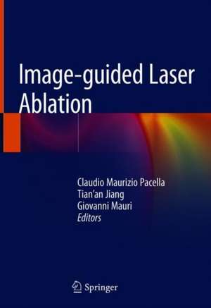 Image-guided Laser Ablation de Claudio Maurizio Pacella