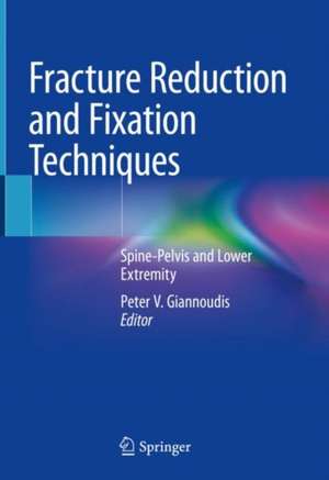 Fracture Reduction and Fixation Techniques: Spine-Pelvis and Lower Extremity de Peter V. Giannoudis