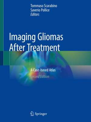 Imaging Gliomas After Treatment: A Case-based Atlas de Tommaso Scarabino