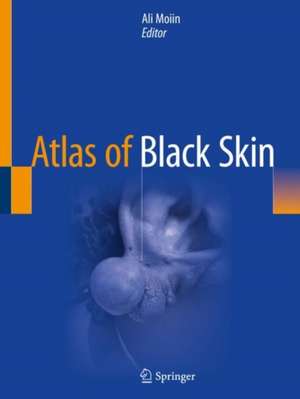 Atlas of Black Skin de Ali Moiin