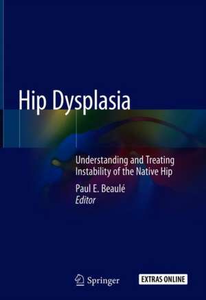 Hip Dysplasia: Understanding and Treating Instability of the Native Hip de Paul E. Beaulé