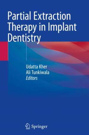 Partial Extraction Therapy in Implant Dentistry de Udatta Kher