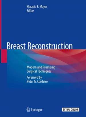 Breast Reconstruction: Modern and Promising Surgical Techniques de Horacio F. Mayer