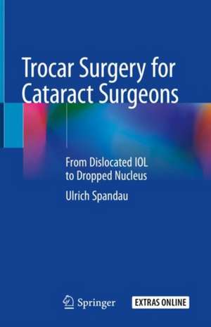 Trocar Surgery for Cataract Surgeons: From Dislocated IOL to Dropped Nucleus de Ulrich Spandau