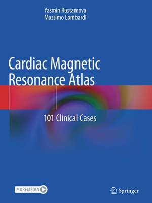 Cardiac Magnetic Resonance Atlas: 101 Clinical Cases de Yasmin Rustamova