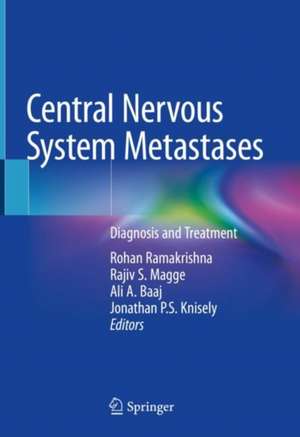 Central Nervous System Metastases: Diagnosis and Treatment de Rohan Ramakrishna