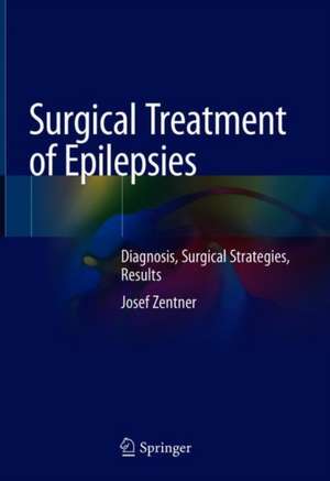 Surgical Treatment of Epilepsies: Diagnosis, Surgical Strategies, Results de Josef Zentner