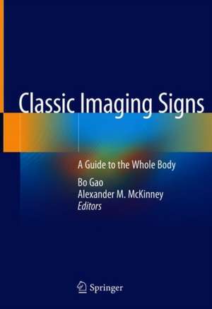 Classic Imaging Signs: A Guide to the Whole Body de Bo Gao