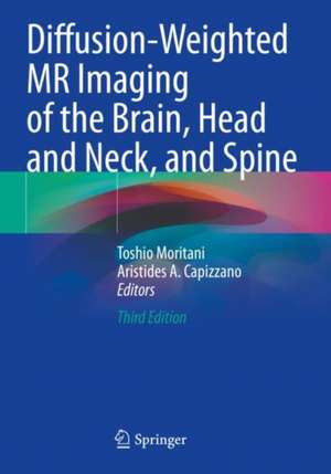 Diffusion-Weighted MR Imaging of the Brain, Head and Neck, and Spine de Toshio Moritani