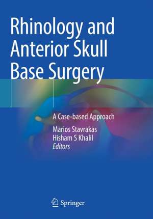 Rhinology and Anterior Skull Base Surgery: A Case-based Approach de Marios Stavrakas