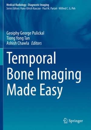 Temporal Bone Imaging Made Easy de Geoiphy George Pulickal