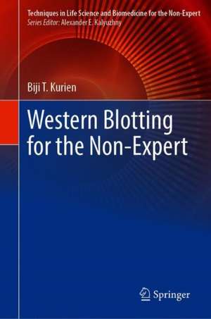 Western Blotting for the Non-Expert de Biji T. Kurien