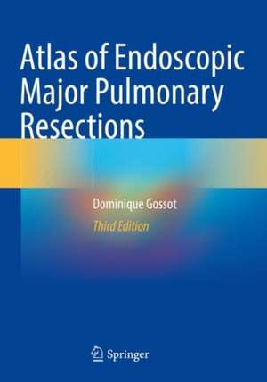 Atlas of Endoscopic Major Pulmonary Resections de Dominique Gossot