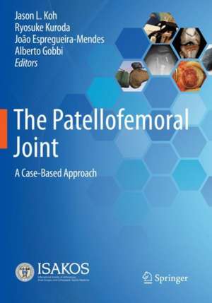 The Patellofemoral Joint: A Case-Based Approach de Jason L. Koh