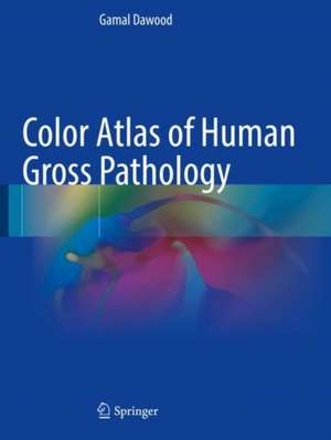 Color Atlas of Human Gross Pathology