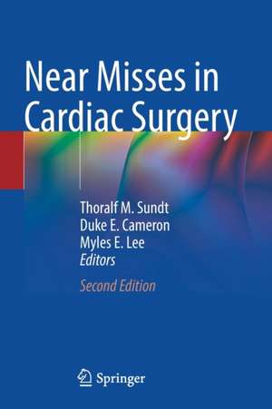 Near Misses in Cardiac Surgery de Thoralf M. Sundt