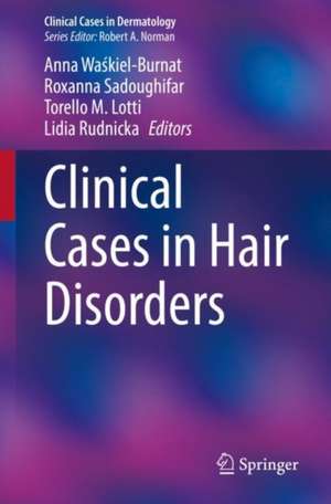 Clinical Cases in Hair Disorders de Anna Waśkiel-Burnat