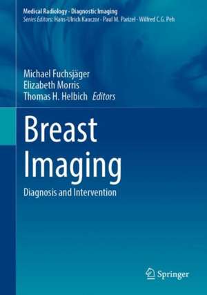 Breast Imaging: Diagnosis and Intervention de Michael Fuchsjäger