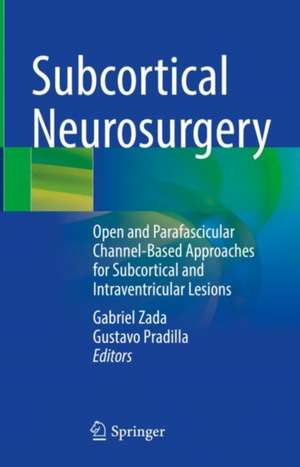 Subcortical Neurosurgery: Open and Parafascicular Channel-Based Approaches for Subcortical and Intraventricular Lesions de Gabriel Zada