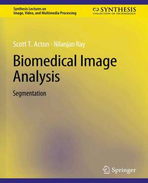 Biomedical Image Analysis: Segmentation de Scott Acton