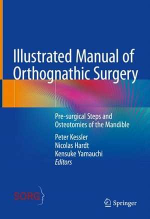 Illustrated Manual of Orthognathic Surgery: Osteotomies of the Mandible de Peter Kessler