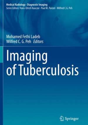 Imaging of Tuberculosis de Mohamed Fethi Ladeb