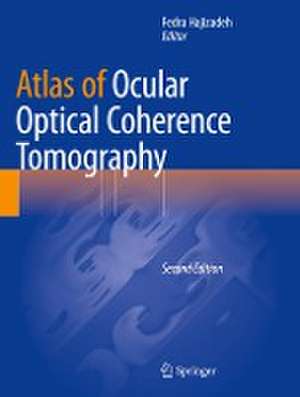 Atlas of Ocular Optical Coherence Tomography de Fedra Hajizadeh