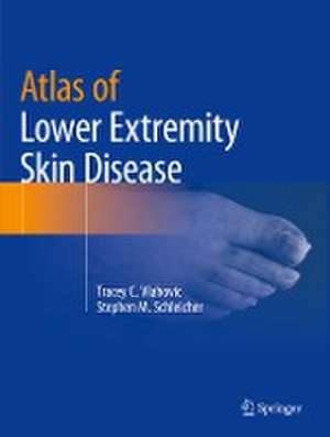 Atlas of Lower Extremity Skin Disease de Tracey C. Vlahovic