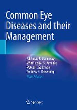 Common Eye Diseases and their Management de Nicholas R. Galloway