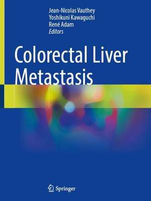 Colorectal Liver Metastasis de Jean-Nicolas Vauthey