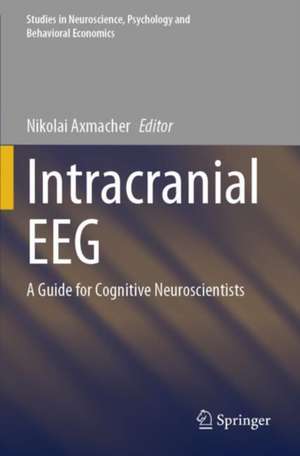 Intracranial EEG de Nikolai Axmacher