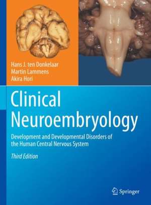 Clinical Neuroembryology: Development and Developmental Disorders of the Human Central Nervous System de Hans J. ten Donkelaar