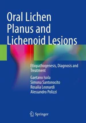 Oral Lichen Planus and Lichenoid Lesions: Etiopathogenesis, Diagnosis and Treatment de Gaetano Isola