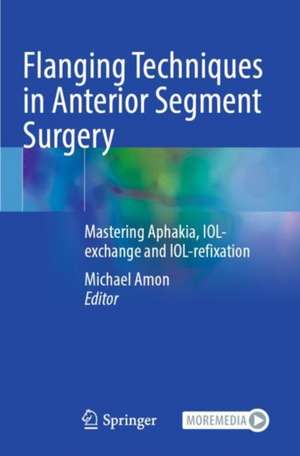 Flanging Techniques in Anterior Segment Surgery de Michael Amon