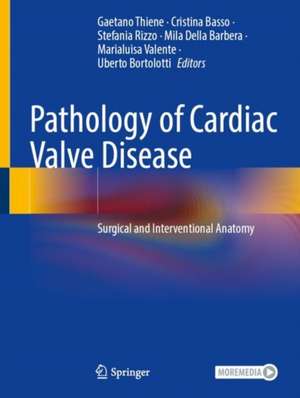 Pathology of Cardiac Valve Disease: Surgical and Interventional Anatomy de Gaetano Thiene