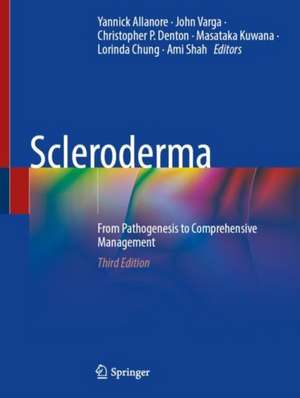 Scleroderma: From Pathogenesis to Comprehensive Management de Yannick Allanore